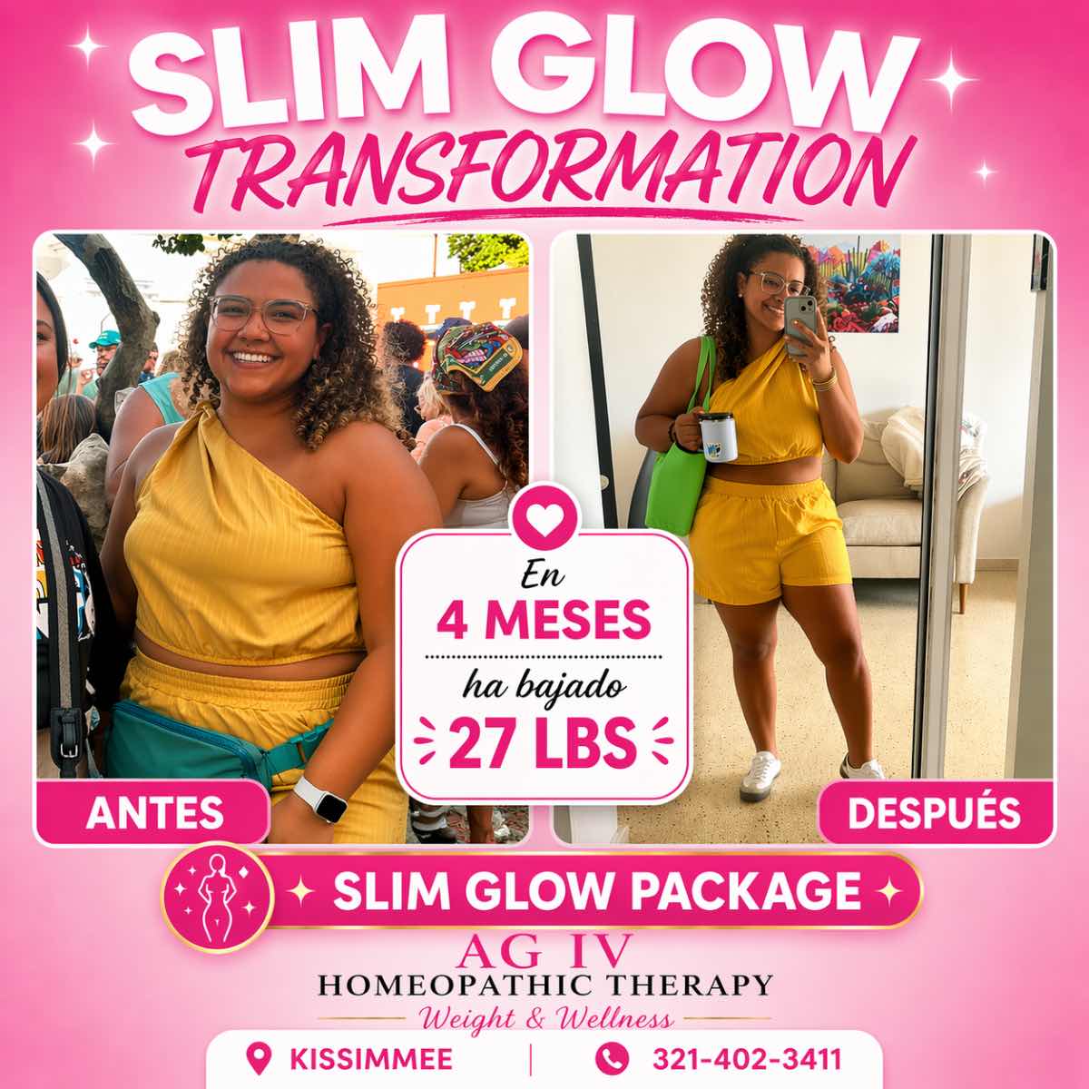 Transformación 1 de Slim Glow